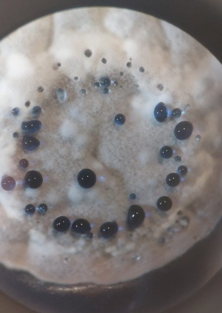 Streptomyces coelicolor