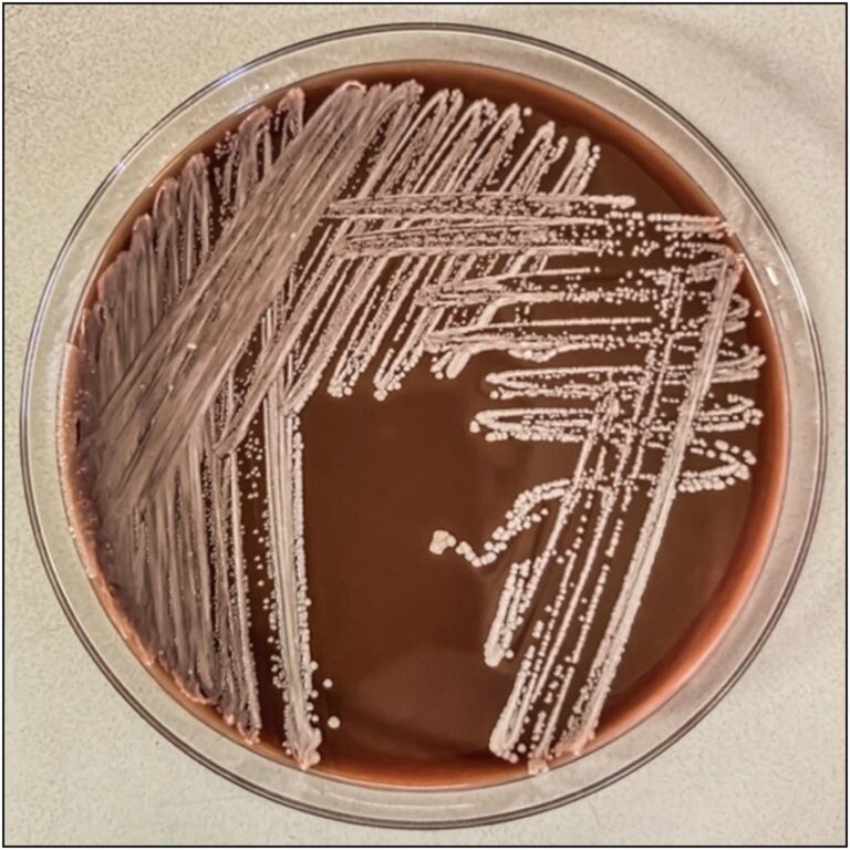 Streptomyces griseus
