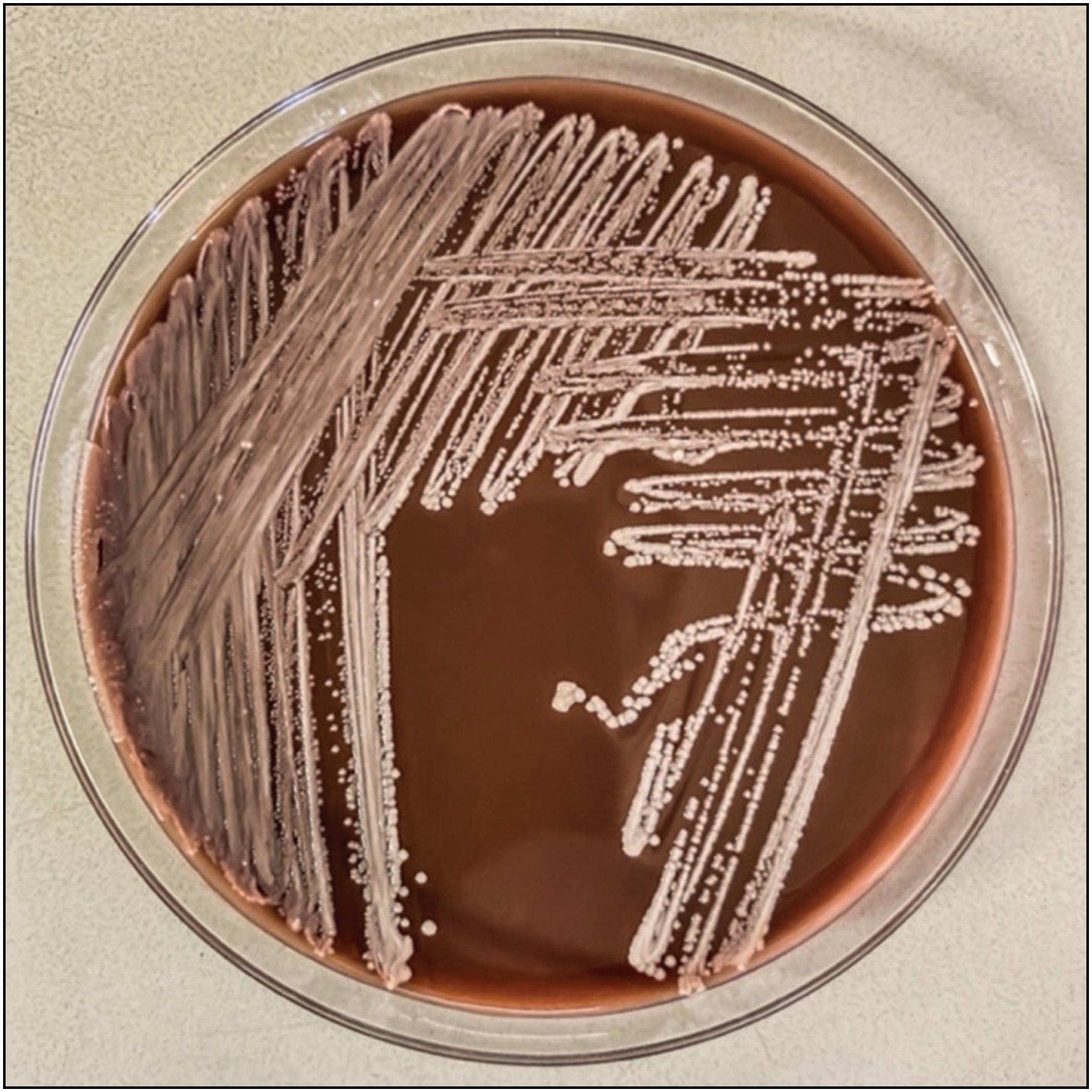 Streptomyces griseus