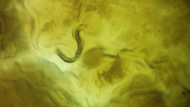 Strongyloides stercoralis