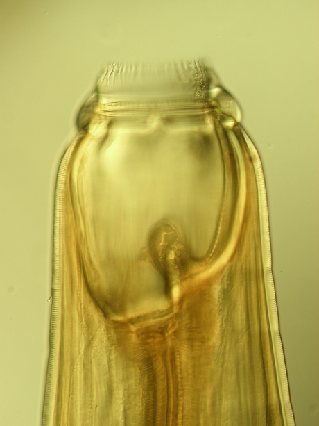 Strongylus vulgaris