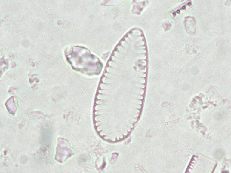 Surirella minuta