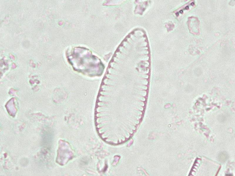 Surirella minuta
