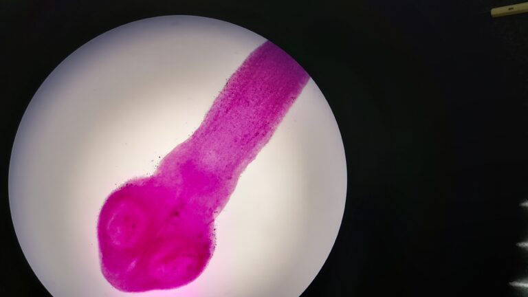 Taenia saginata