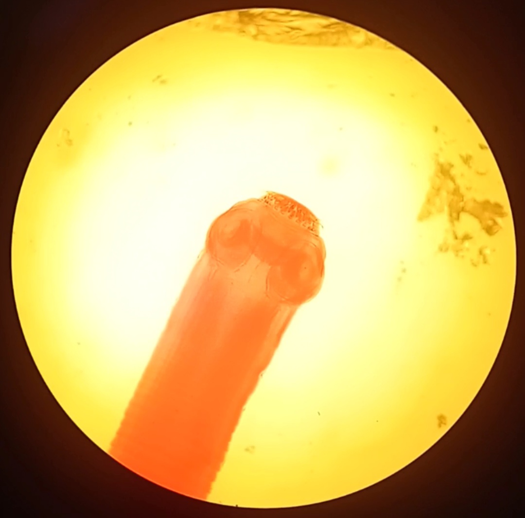 Taenia solium