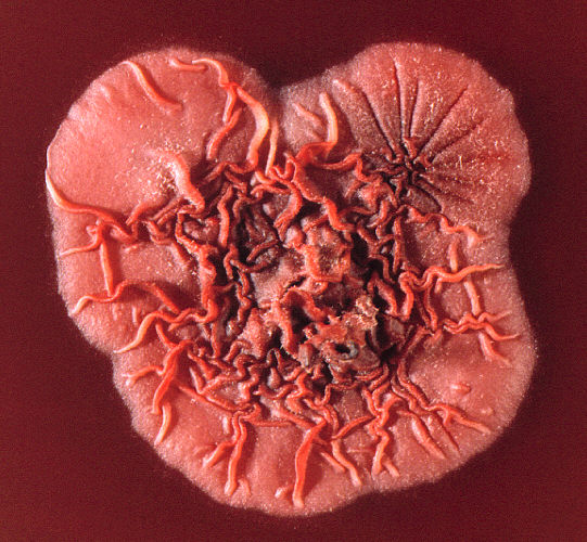 Talaromyces marneffei