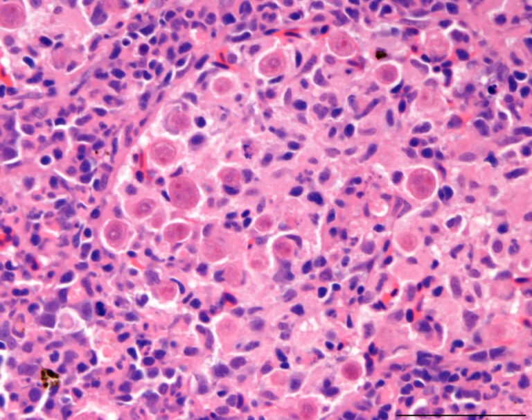 Tetracapsuloides bryosalmonae