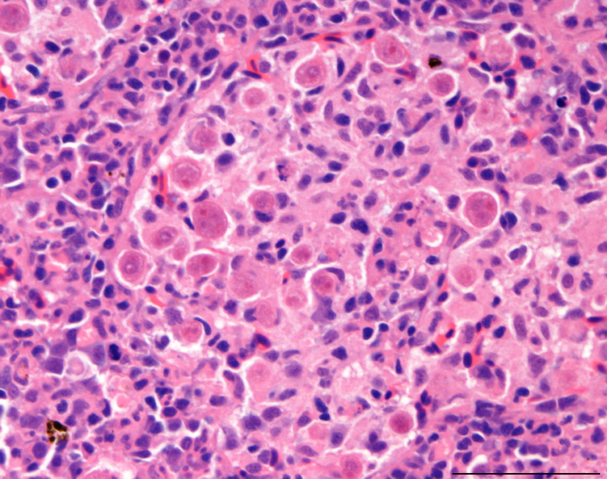Tetracapsuloides bryosalmonae