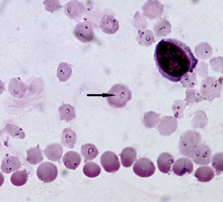 Theileria annulata