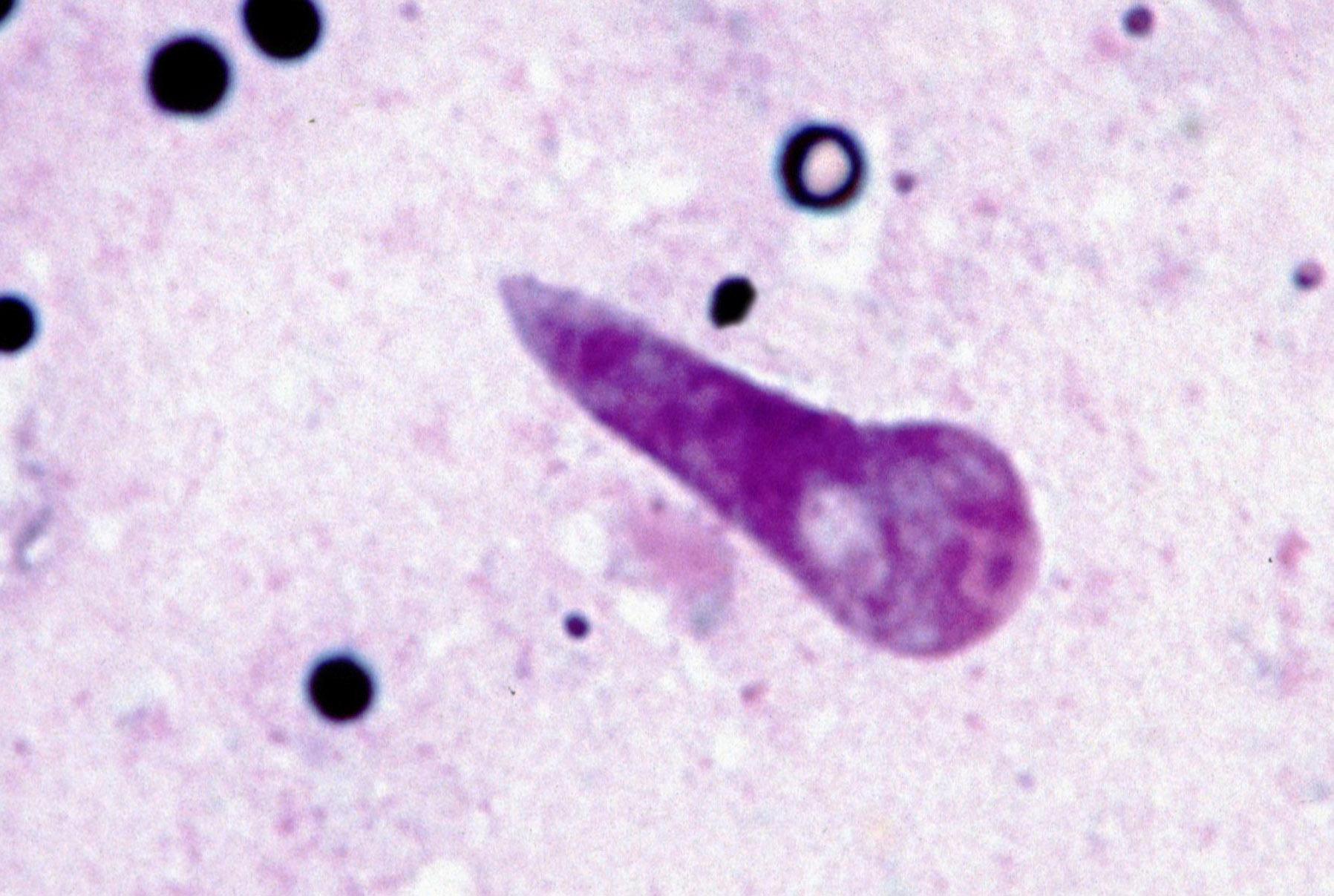 Theileria parva