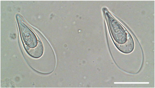 Thelohanellus kitauei