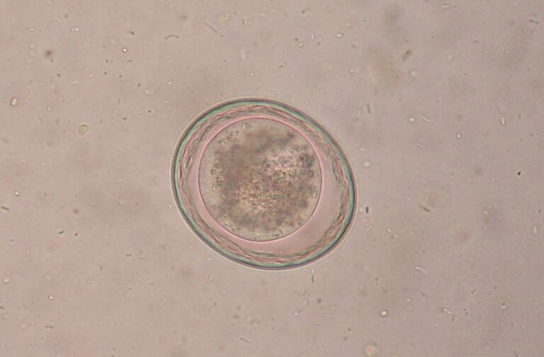 Toxascaris leonina
