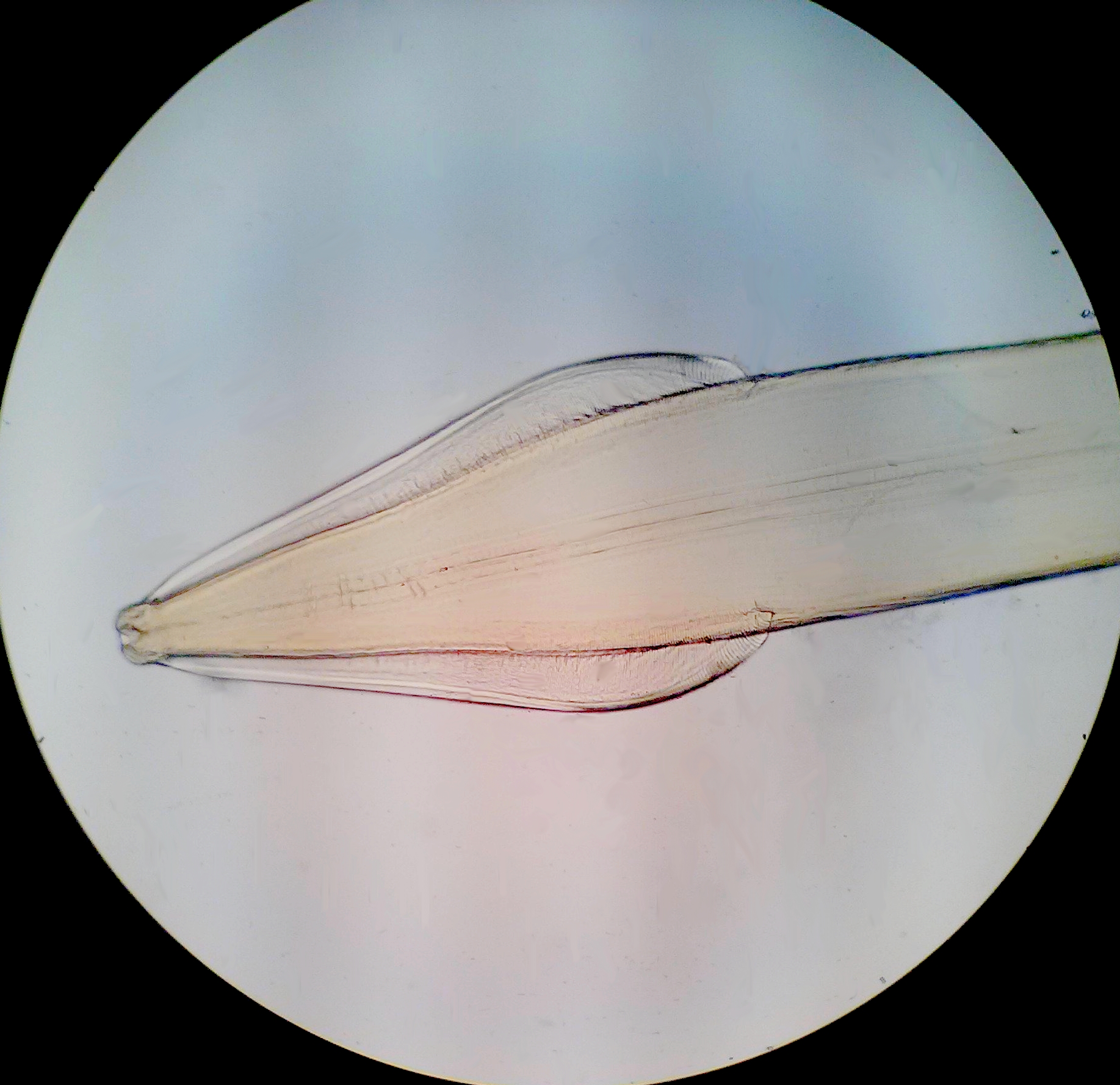 Toxocara cati