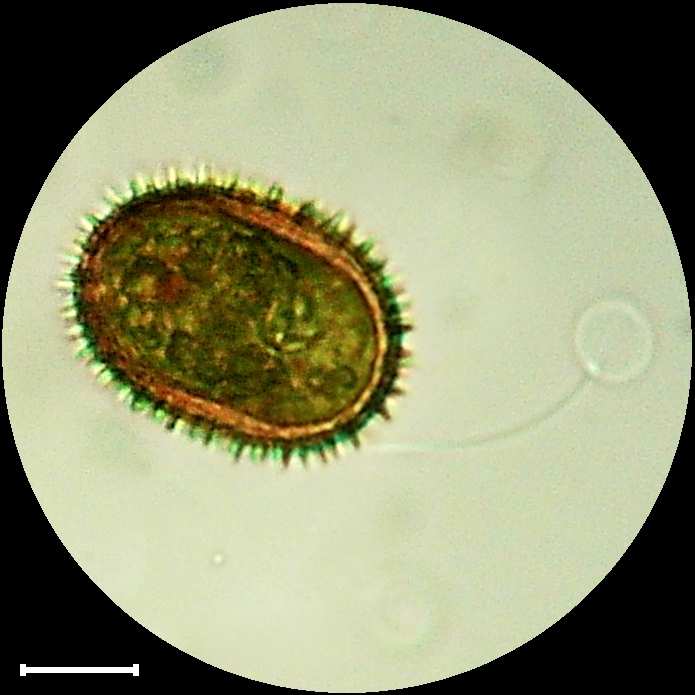 Trachelomonas hispida Trachelomonas hispida