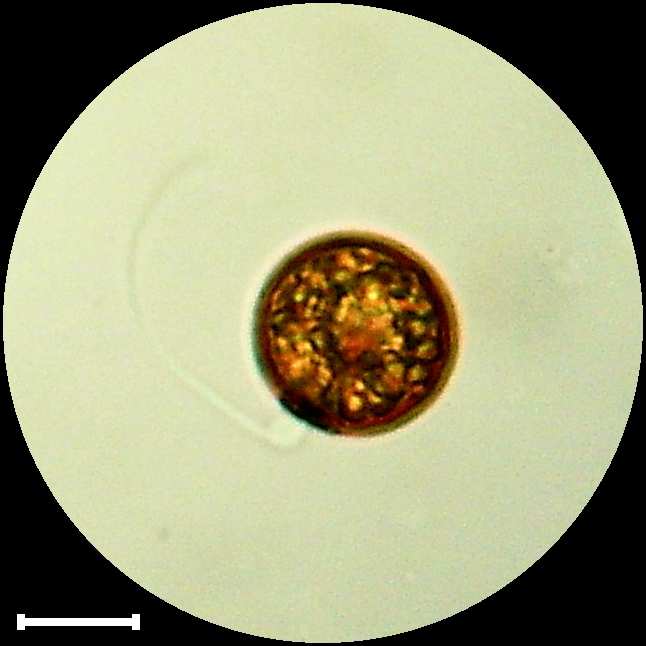 Trachelomonas volvocina