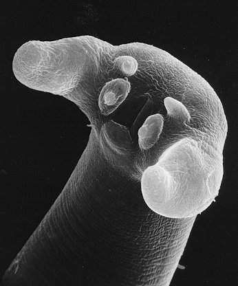 Trichinella nativa