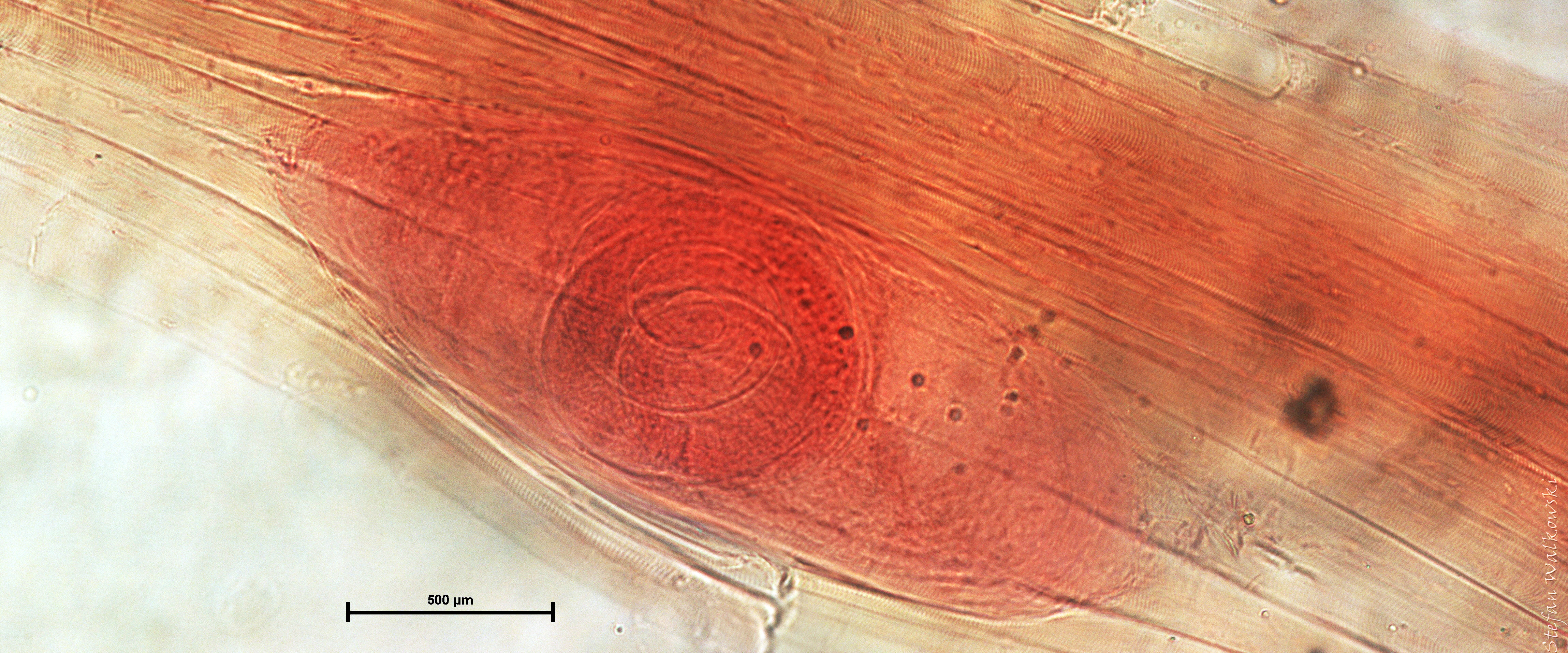 Trichinella spiralis