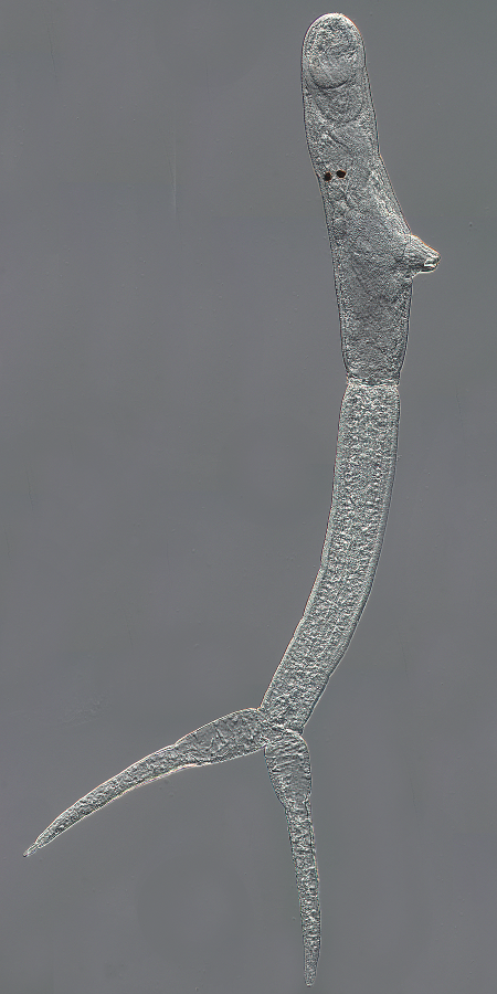 Trichobilharzia regenti