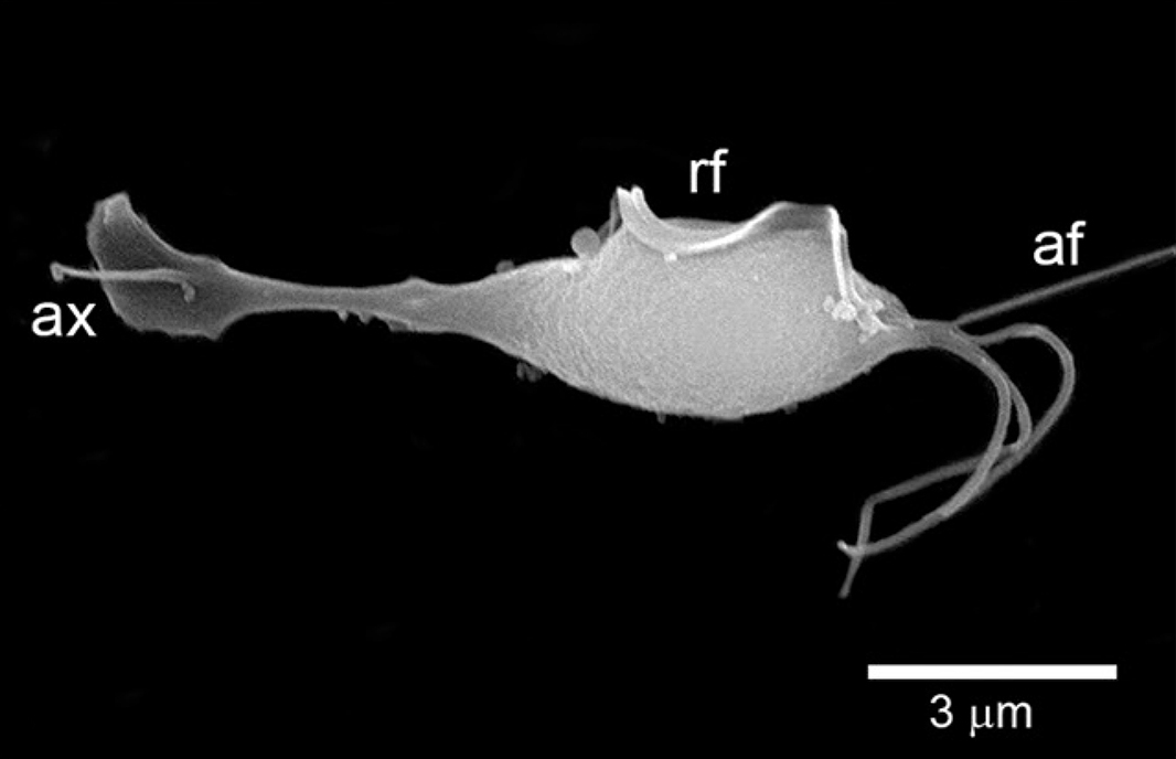 Trichomonas vaginalis
