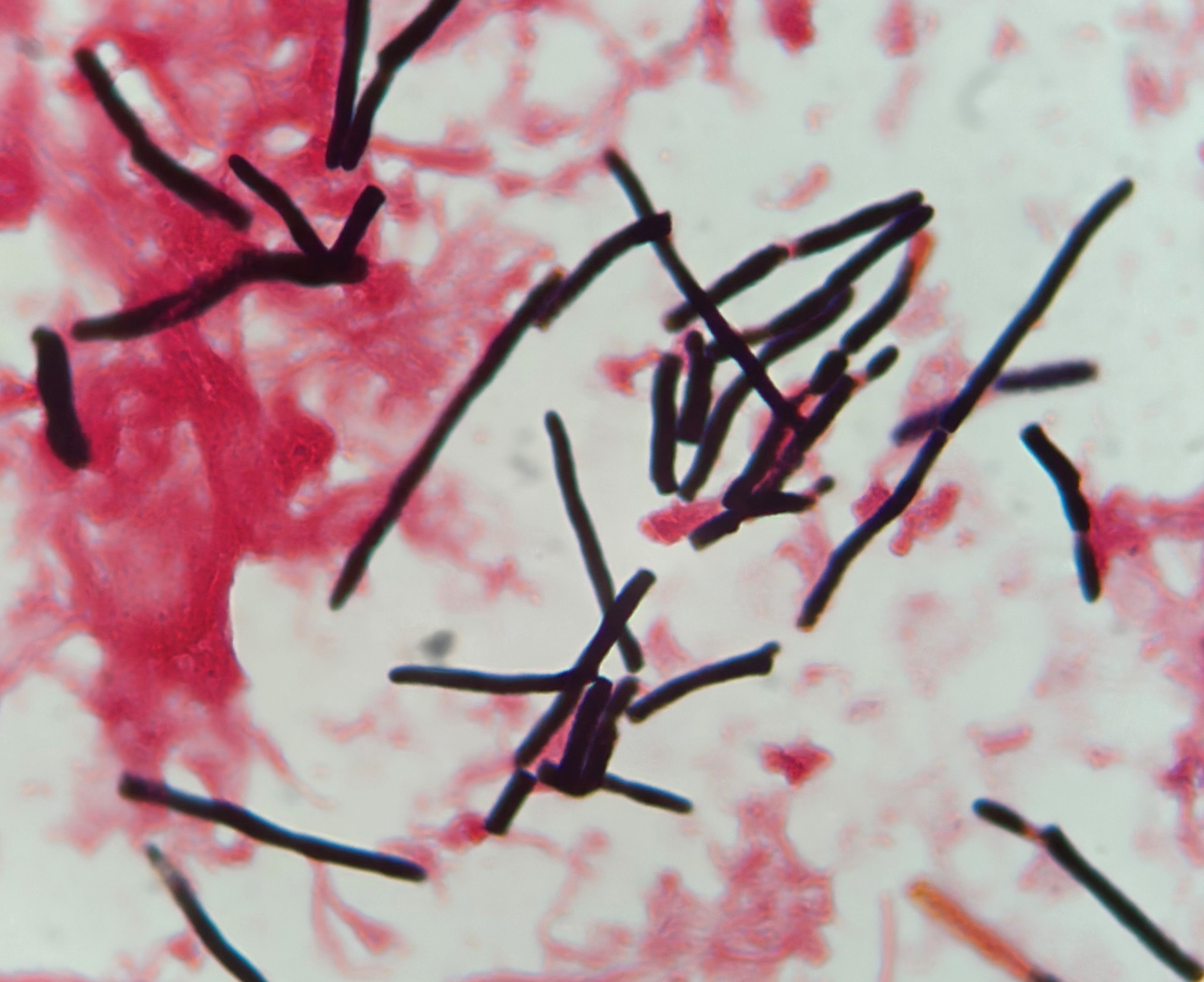 Trichosporon asahii