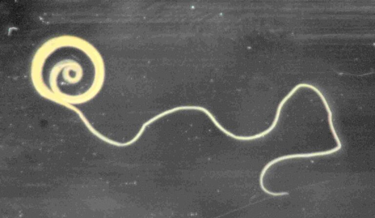 Trichuris suis