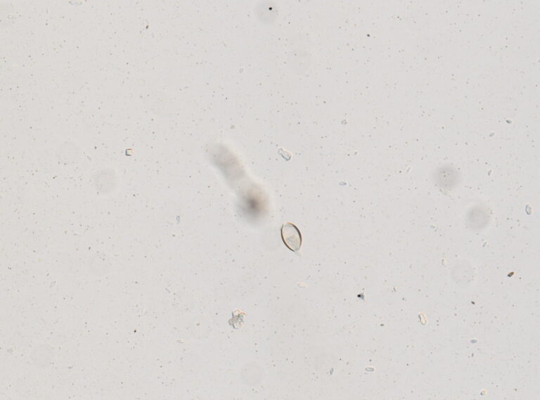 Trichuris vulpis