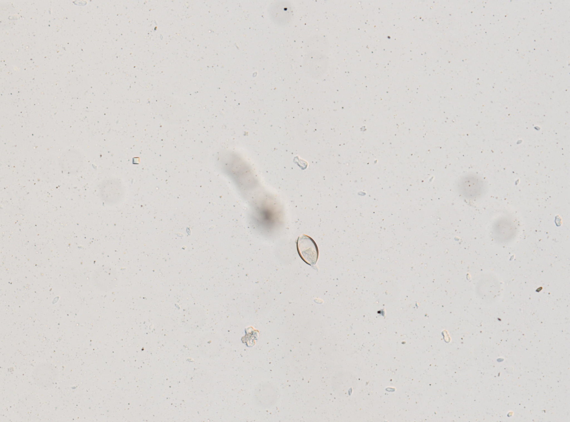 Trichuris vulpis