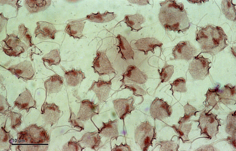 Tritrichomonas foetus Tritrichomonas foetus