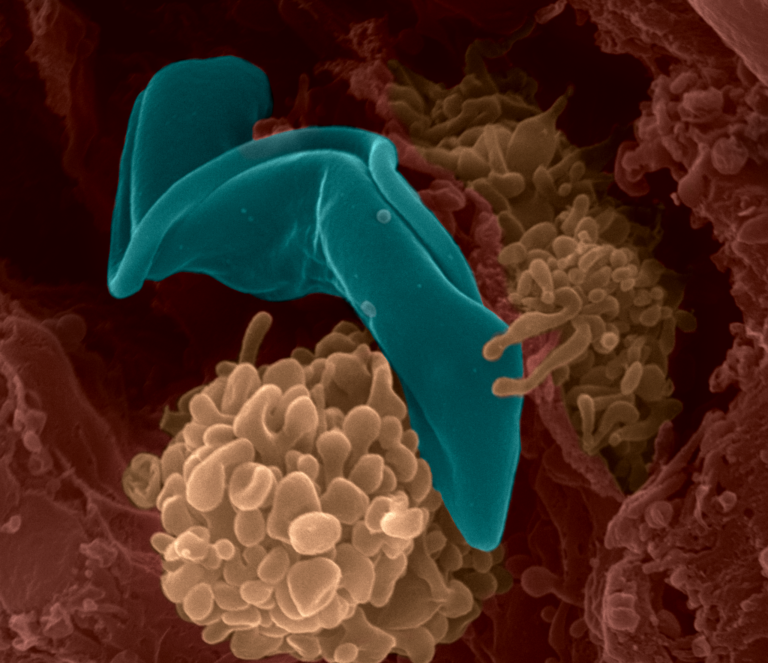 Trypanosoma brucei