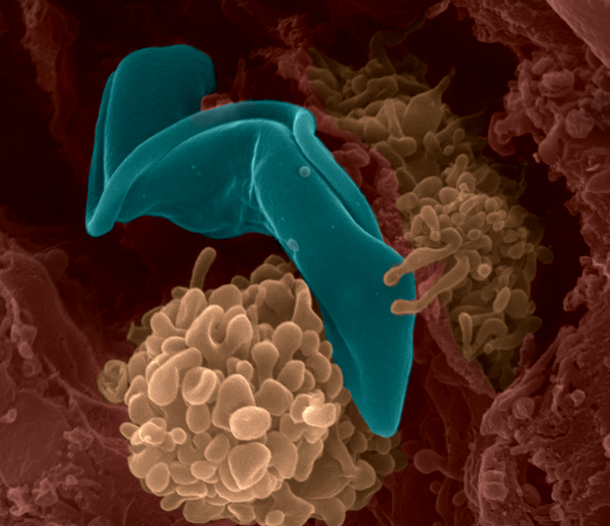 Trypanosoma brucei
