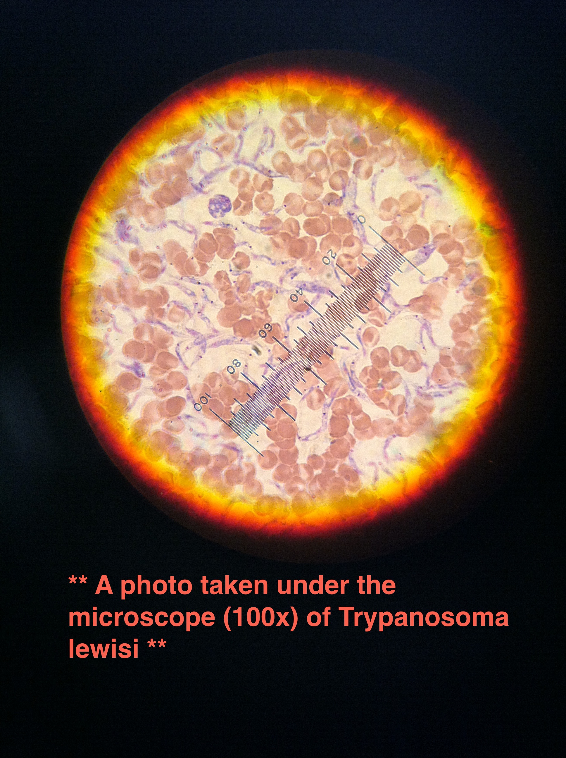 Trypanosoma lewisi