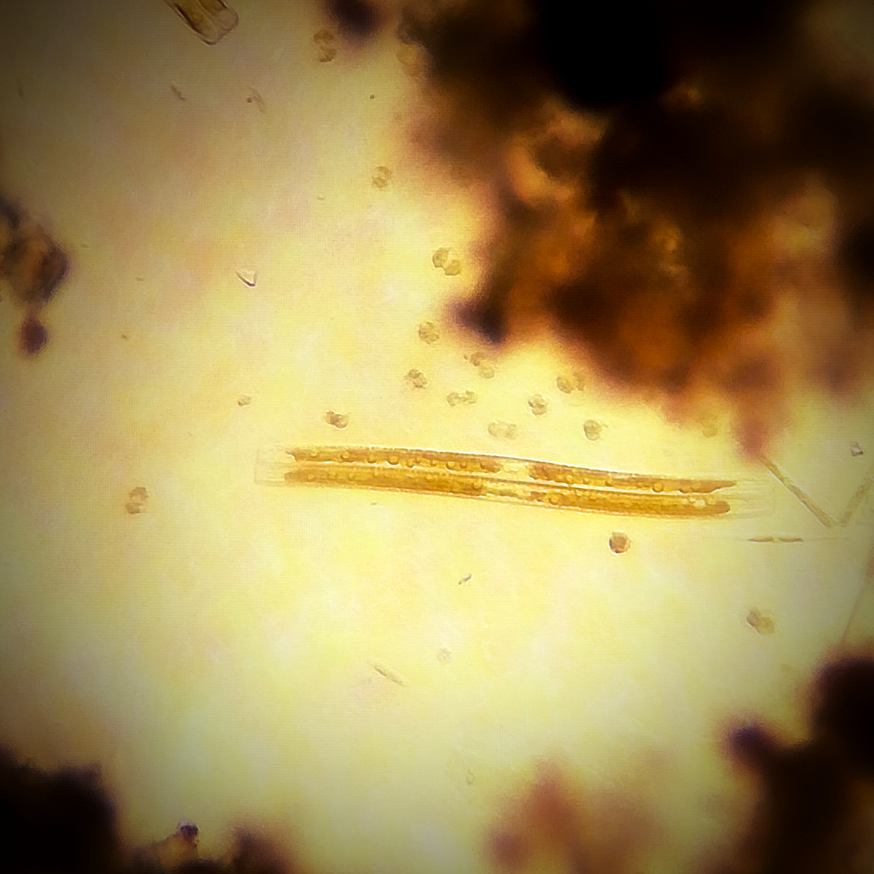Ulnaria ulna
