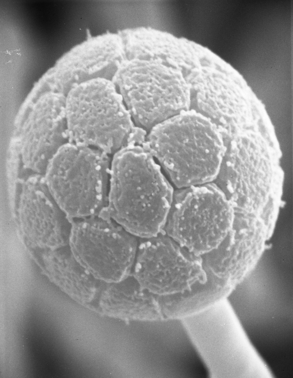 Umbelopsis isabellina