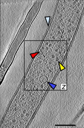 Vairimorpha necatrix