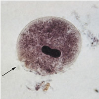 vakovka lidská (Balantidium coli)
