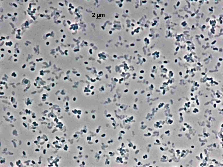 Vibrio anguillarum