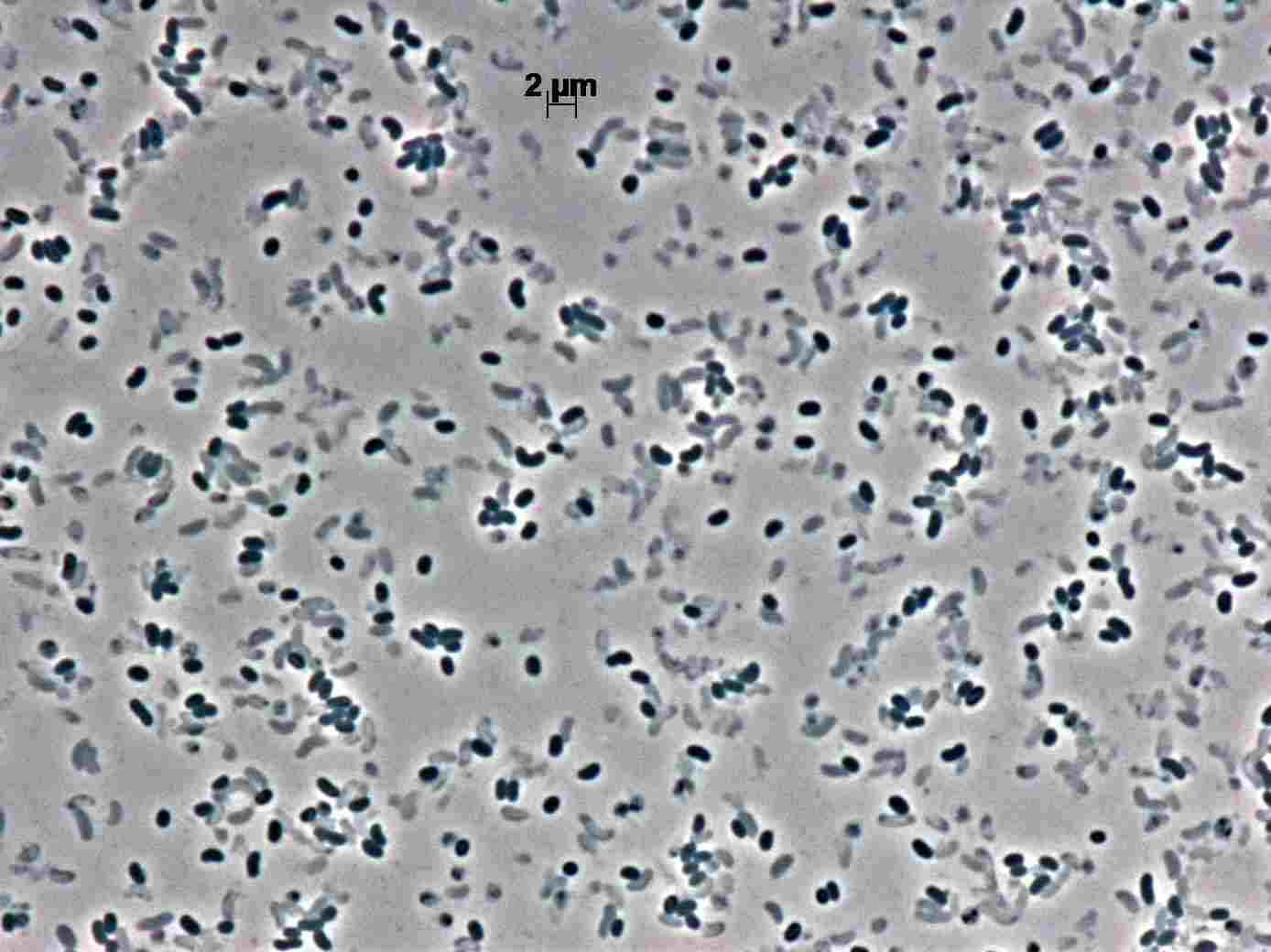 Vibrio anguillarum