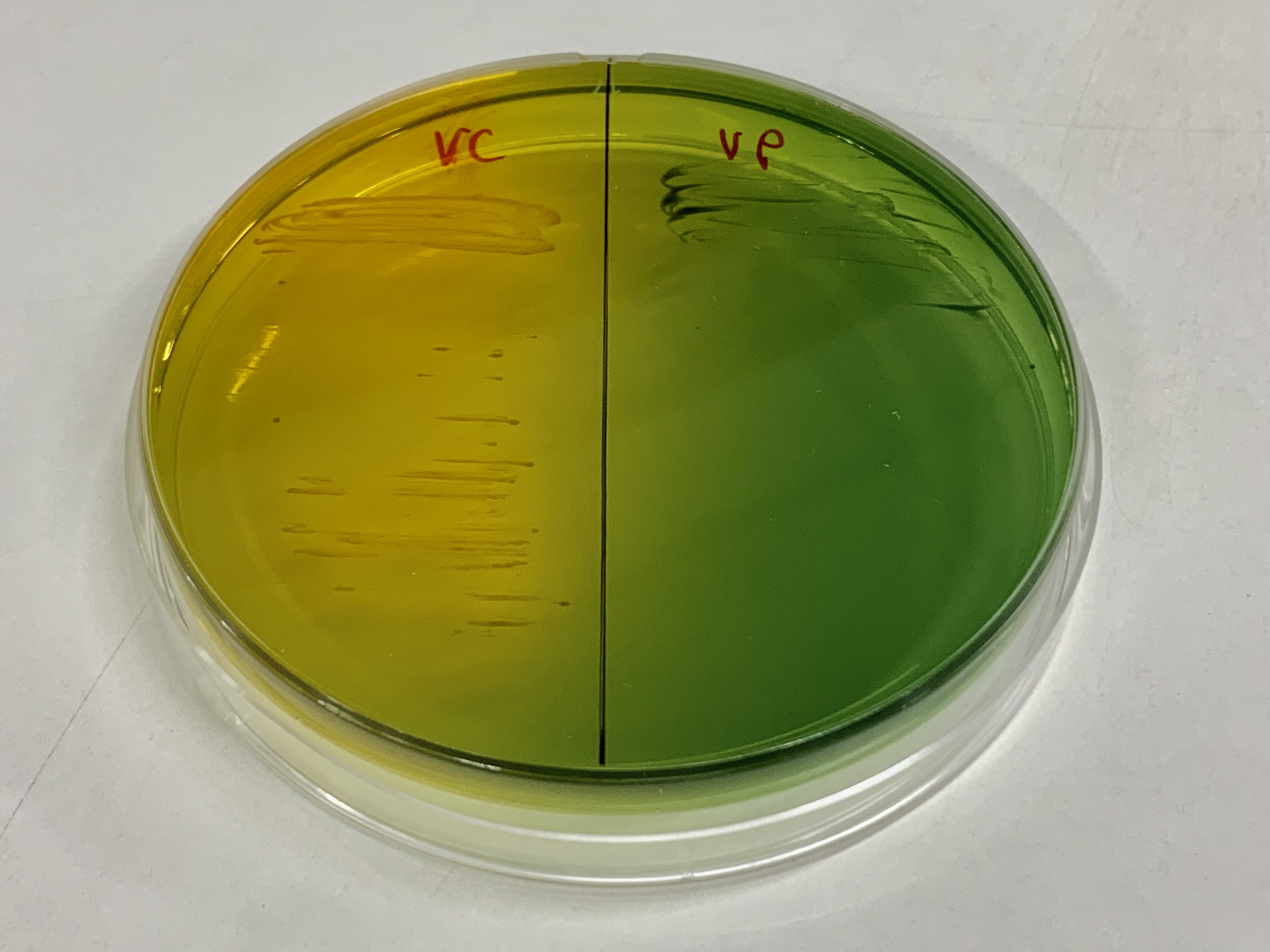 Vibrio cholerae