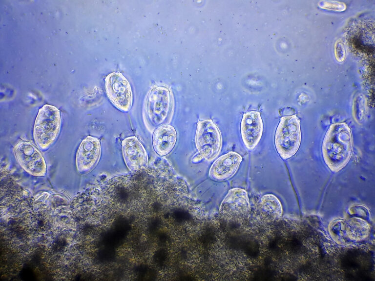 Vorticella microstoma Vorticella microstoma