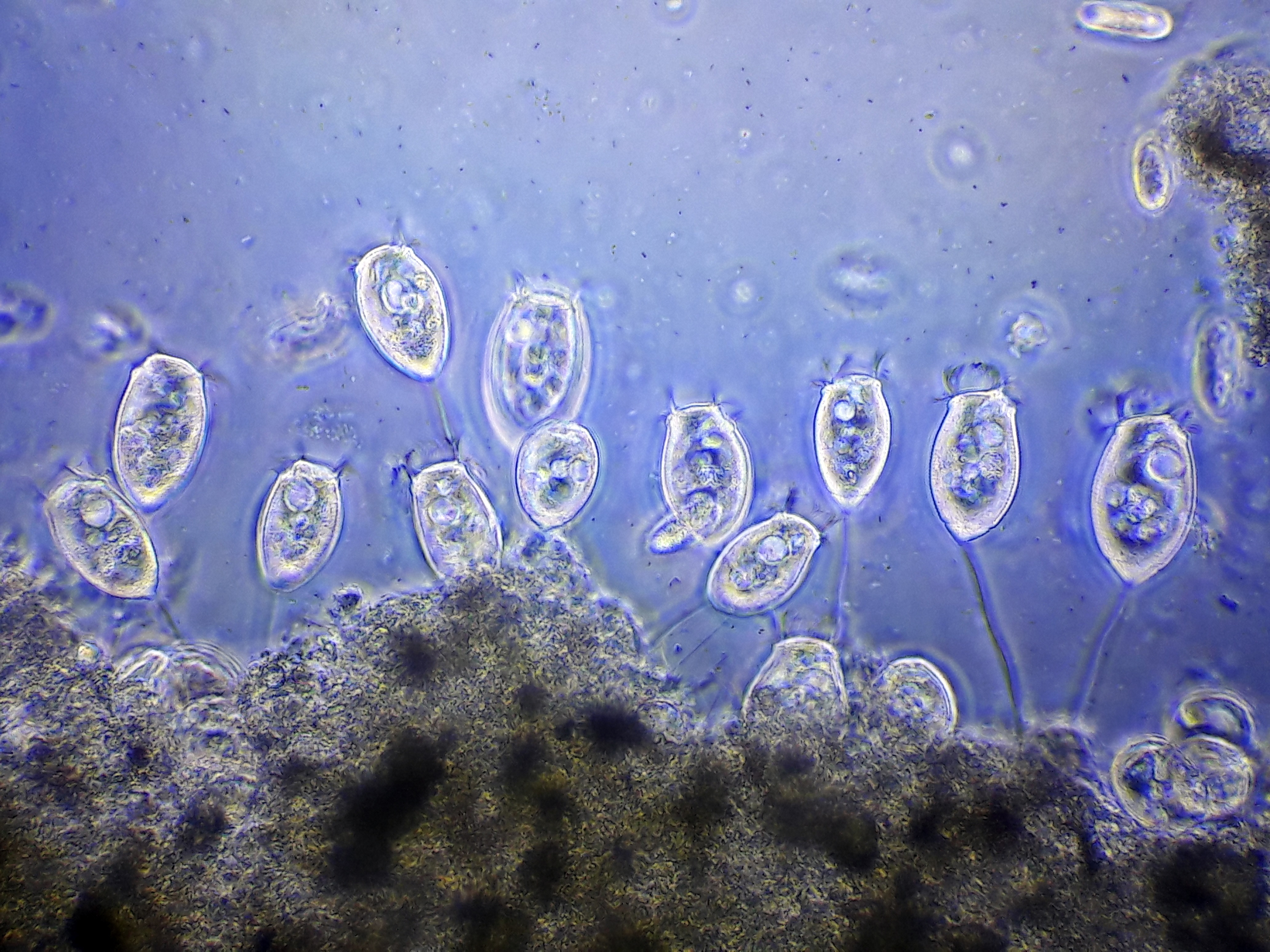 Vorticella microstoma