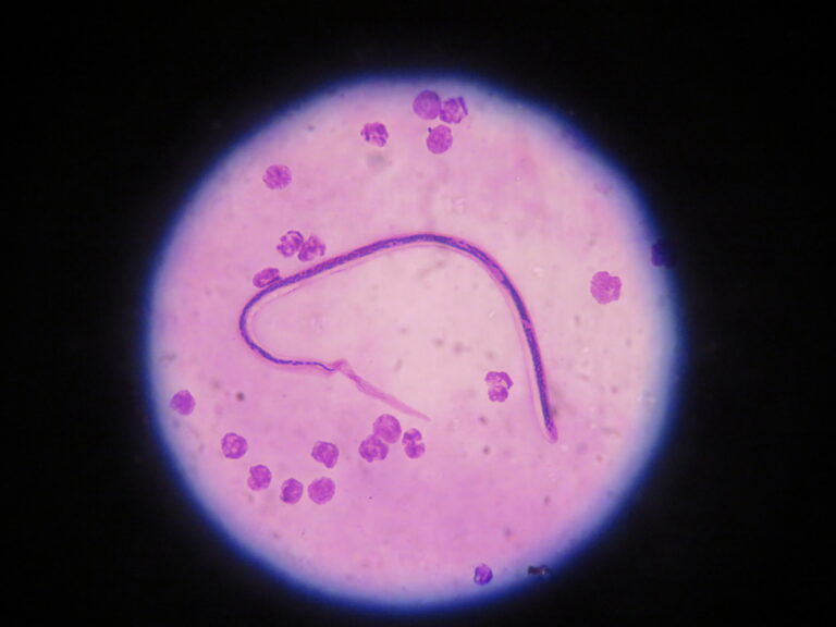 Wuchereria bancrofti