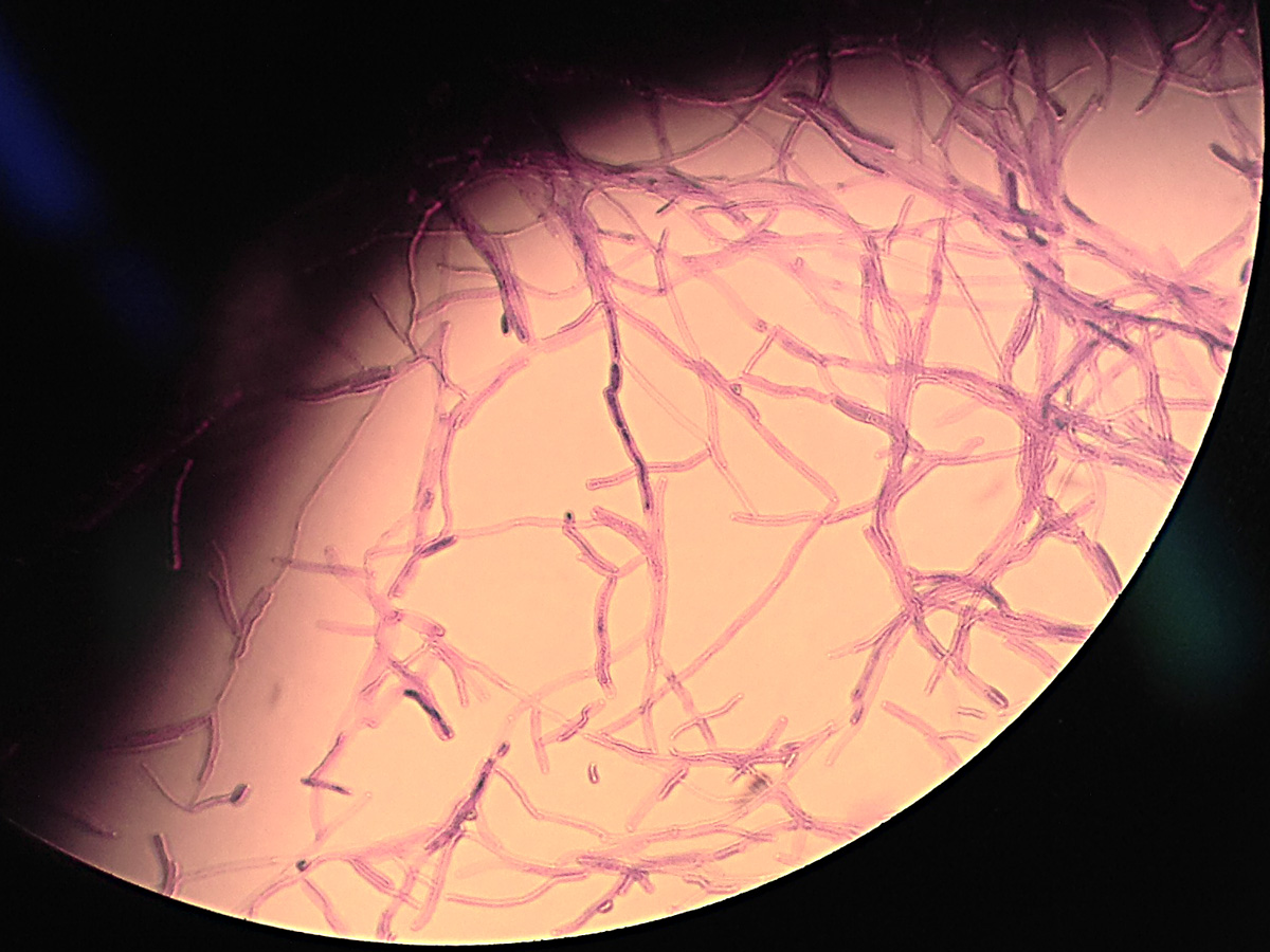 Yarrowia lipolytica