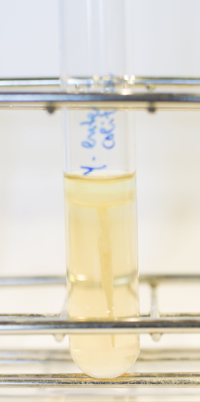 Yersinia enterocolitica
