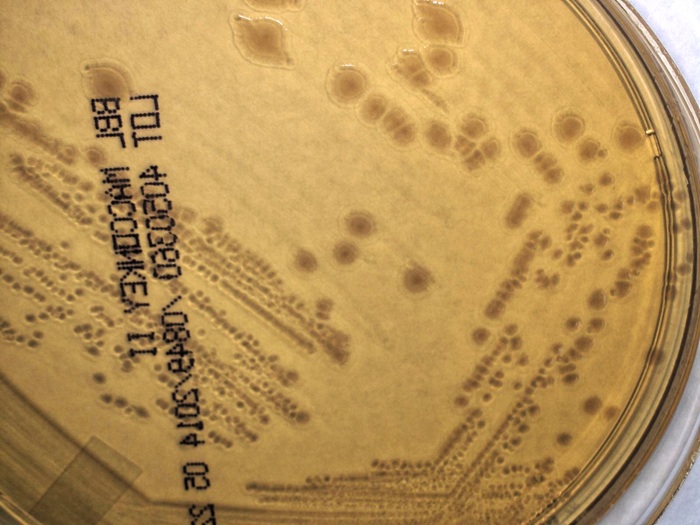 Yersinia pseudotuberculosis