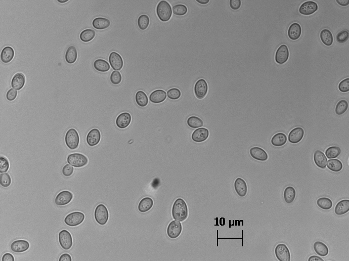 Zygosaccharomyces bailii